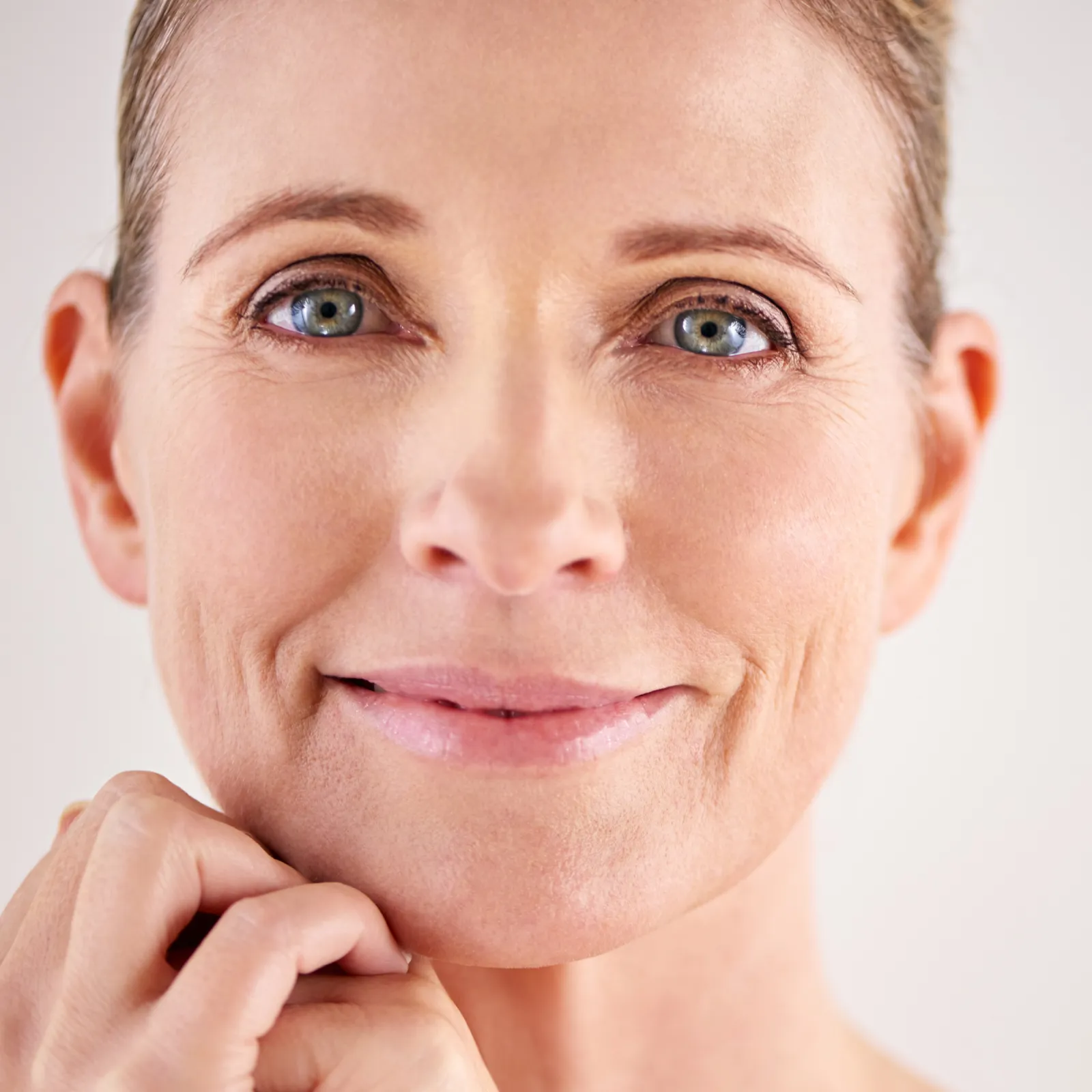 Frau mit harmonischen Gesichtszügen nach einer Hyaluron-Filler-Behandlung